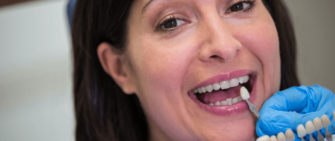 Dentist examining female patient with teeth shades.